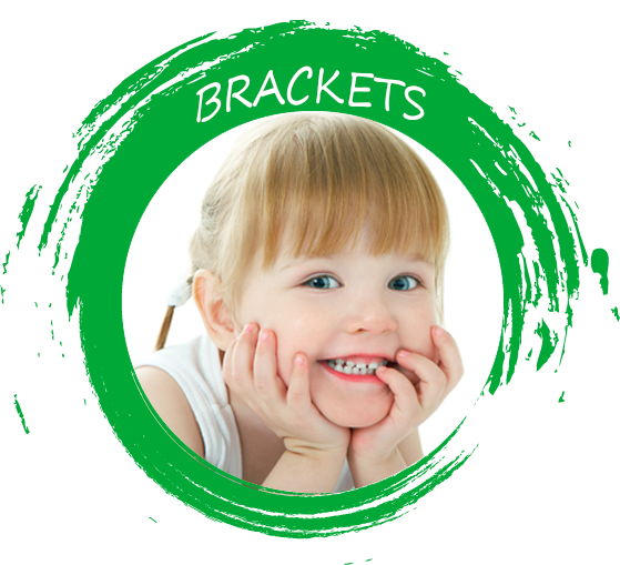ortodoncia para niños brackets
